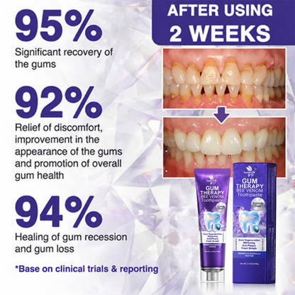 TopSpire® VioCore Bee Venom Dental Treatment Toothpaste