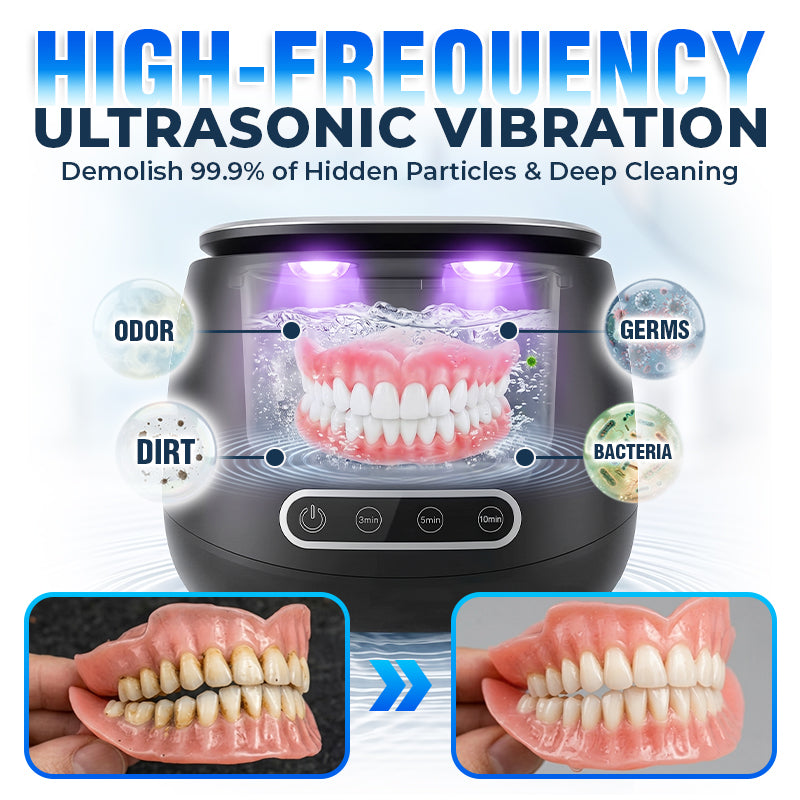 ⭐️TopSpire® 25W Deep Cleaning Denture Ultrasonic Cleaner for Retainers, Mouth Guards, Aligner