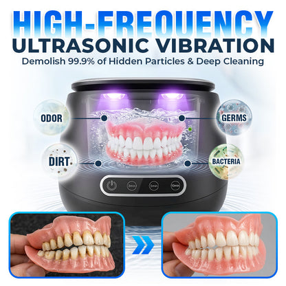 ⭐️TopSpire® 25W Deep Cleaning Denture Ultrasonic Cleaner for Retainers, Mouth Guards, Aligner
