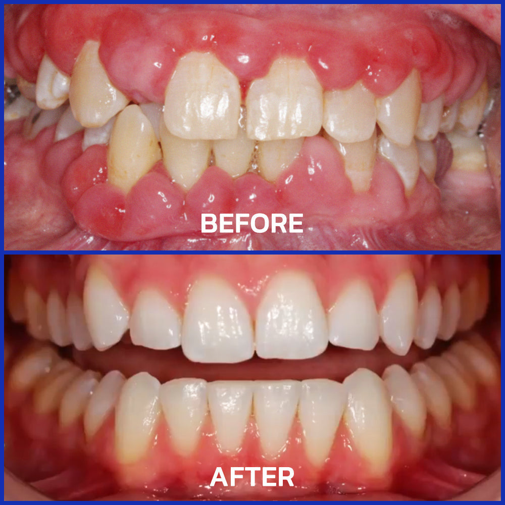 TopSpire® VioCore Bee Venom Dental Treatment Toothpaste