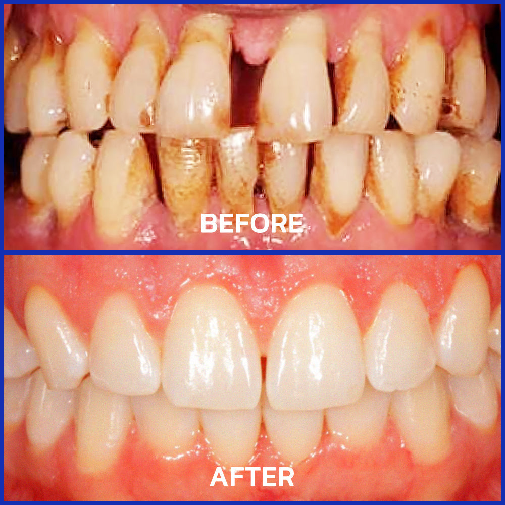 TopSpire® VioCore Bee Venom Dental Treatment Toothpaste